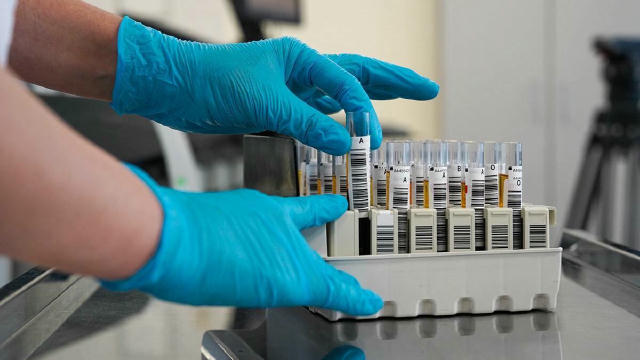 💉 В ближайшие месяцы в России бесплатно начнут ставить вакцину от рака. Препарат «Энтеромикс» уже доказал эффективность даже