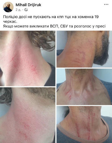 У Черкасах чоловіка вже понад тиждень утримують в ТЦК. Його схопили, коли він добровільно прийшов оновити дані. Просто зачини