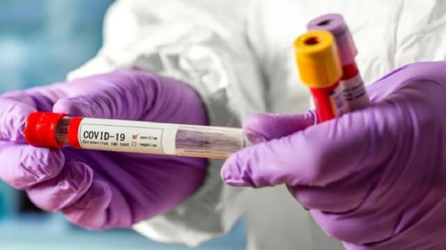 ❗️ ЧЕРНІВЦІГРАМ ІНФОРМУЄ: на Буковині знову виявили випадки COVID-19 За минулий тиждень у Чернівецькій області зареєстровано 