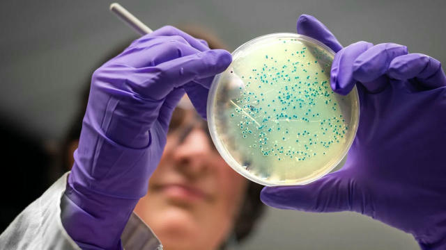 KI entwickelt neue Antibiotika gegen Supererreger Forschende am MIT haben mithilfe von KI zwei neue Antibiotika entworfen, di