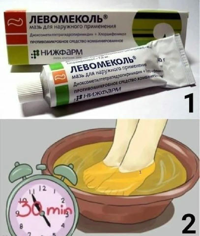 Левомеколь — настоящий кладезь здоровья, о котором Вам не расскажут в аптеке. Лишь 5% людей знают, как правильно использовать