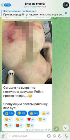 Сегодня на вскрытии... Это был самый жуткий случай в моей карьере. Без цензуры и прикрас: работа в морге. Внимание: этот мате