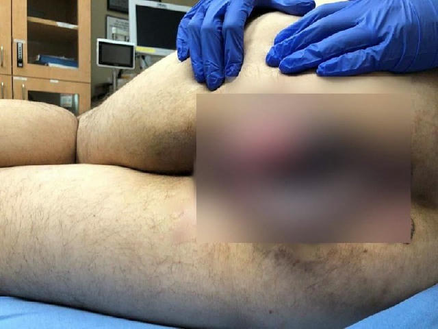 Безобразие 😱 - самый мерзкий канал в телеграм, где можно увидеть жуть со всего мира! Слабонервным не входить🔞 https://t.me/
