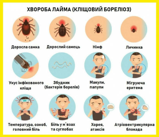 📈 ЗРОСТАЄ кількість випадків зараження на хворобу Лайма. З 30 червня по 6 липня виявили 23 випадки захворювання. Рівень зара